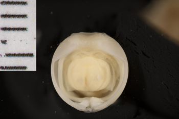 Media type: image;   Malacology 169662 Description: Digital documentation photo of preserved specimen.;